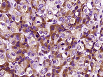 CRP (C11F2) Mouse Monoclonal Antibody