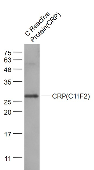 CRP (C11F2) Mouse Monoclonal Antibody