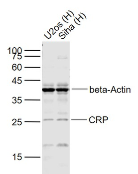 CRP (C11F2) Mouse Monoclonal Antibody