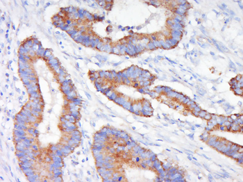 MEK1 Rabbit Polyclonal Antibody