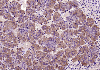 CRF Rabbit Polyclonal Antibody