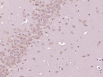 CRF Rabbit Polyclonal Antibody