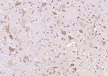 CRF Rabbit Polyclonal Antibody
