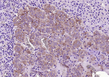 CRF Rabbit Polyclonal Antibody