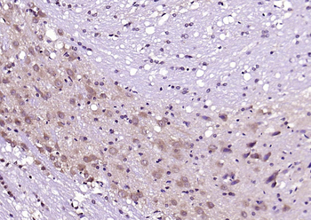 CRF Rabbit Polyclonal Antibody