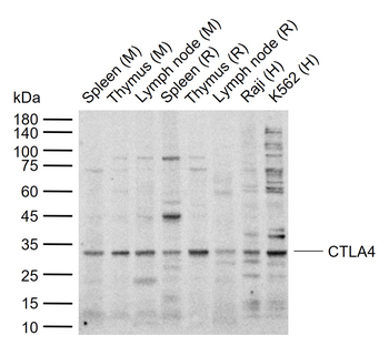 CTLA4 Rabbit Polyclonal Antibody