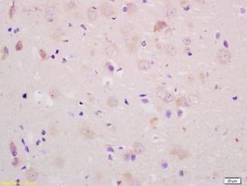 RAMP1 Rabbit Polyclonal Antibody