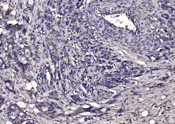 PIK3R1 Rabbit Polyclonal Antibody