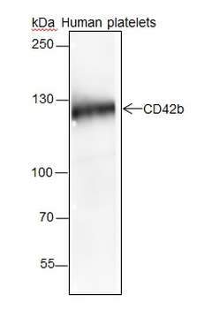 GP1BA Recombinant Rabbit Monoclonal Antibody