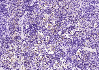 GP1BA Recombinant Rabbit Monoclonal Antibody