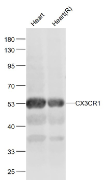 CX3CR1 Rabbit Polyclonal Antibody