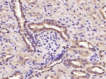 Cyclin D1 Rabbit Polyclonal Antibody