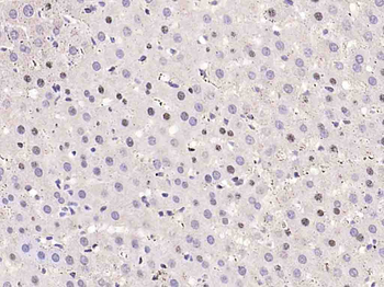 Cyclin D1 Rabbit Polyclonal Antibody