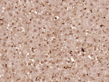 Cyclin D1 Rabbit Polyclonal Antibody