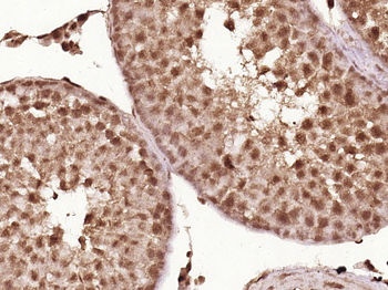 Cyclin D1 Rabbit Polyclonal Antibody