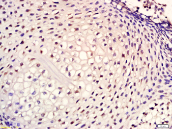 Cytokeratin 1 Rabbit Polyclonal Antibody