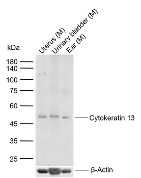 Cytokeratin 13 Rabbit Polyclonal Antibody