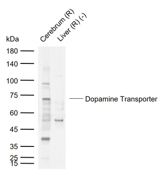 Dopamine Transporter Rabbit Polyclonal Antibody