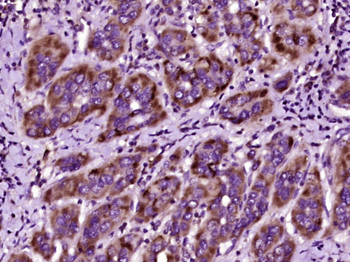 F2 Rabbit Polyclonal Antibody