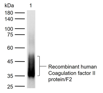 F2 Rabbit Polyclonal Antibody