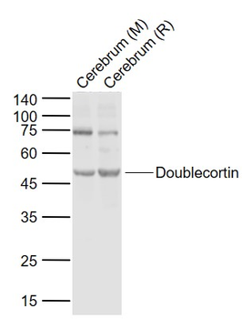 Doublecortin Rabbit Polyclonal Antibody