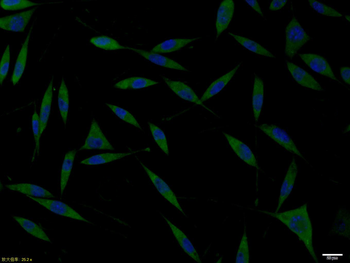 Doublecortin Rabbit Polyclonal Antibody