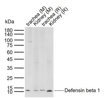 Defensin beta 1 Rabbit Polyclonal Antibody