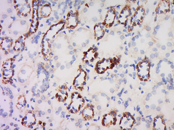 Defensin beta 2 Rabbit Polyclonal Antibody