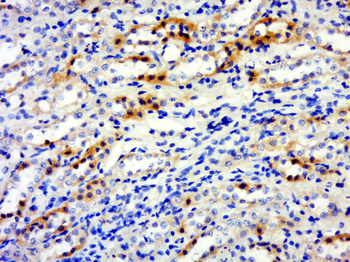 DAP5 Rabbit Polyclonal Antibody