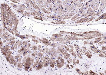 Desmin Rabbit Polyclonal Antibody