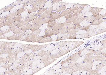 Desmin Rabbit Polyclonal Antibody