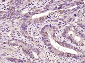 PARK7/DJ1 Rabbit Polyclonal Antibody