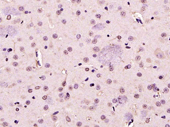 PARK7/DJ1 Rabbit Polyclonal Antibody