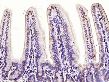 Dnmt3b Rabbit Polyclonal Antibody