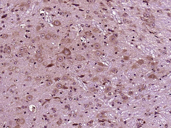 DR3 Rabbit Polyclonal Antibody