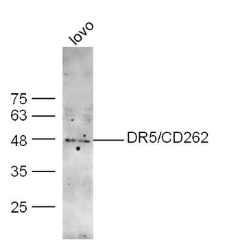 DR5 Rabbit Polyclonal Antibody