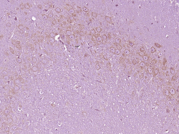 DTNBP1 Rabbit Polyclonal Antibody