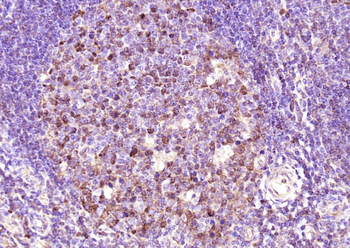 DUTPase Rabbit Polyclonal Antibody