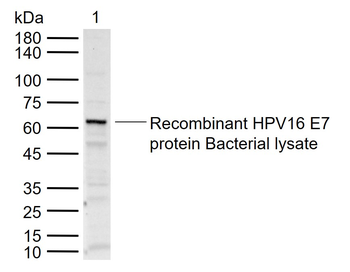 HPV16 E7 Rabbit Polyclonal Antibody