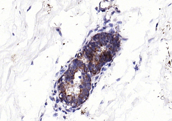 ECM1 Rabbit Polyclonal Antibody