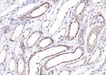 ECM1 Rabbit Polyclonal Antibody