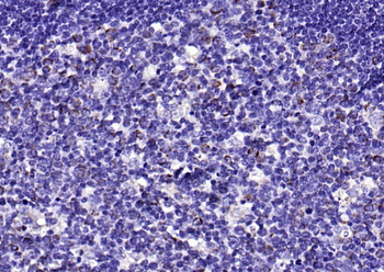 ECM1 Rabbit Polyclonal Antibody