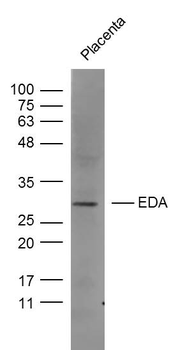 EDA Rabbit Polyclonal Antibody