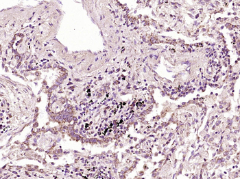 EGFR Rabbit Polyclonal Antibody