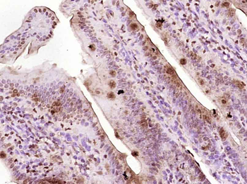 Egr1 Rabbit Polyclonal Antibody