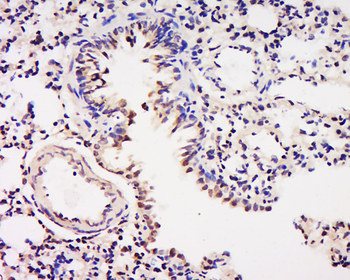 ELK1 Rabbit Polyclonal Antibody