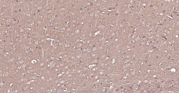 VGLUT1/BNP1 Rabbit Polyclonal Antibody