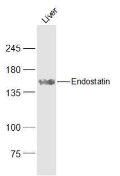 Endostatin Rabbit Polyclonal Antibody