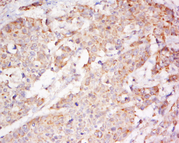 EphB2 Rabbit Polyclonal Antibody