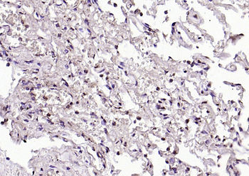 Phospho-Lyn (Tyr507) Rabbit Polyclonal Antibody